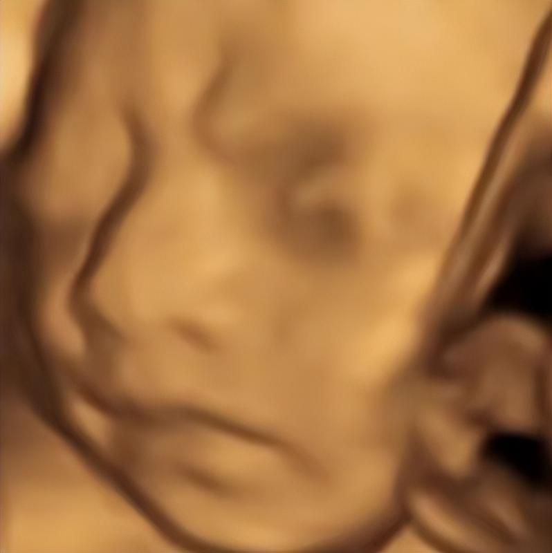 AI四维彩超预测,一单9.9-98,3分钟出图,一天变现1000+【揭秘】 AI四维彩超预测,一单9.9-98,3分钟出图,一天变现1000+【揭秘】